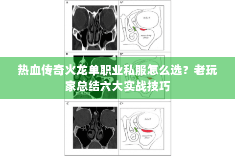热血传奇火龙单职业私服怎么选？老玩家总结六大实战技巧