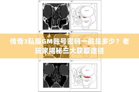 传奇3私服GM账号密码一般是多少？老玩家揭秘三大获取途径